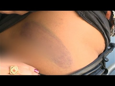 بالفيديو أم مغربية تكشف تفاصيل اعتداء أحد أساتذتها عليها جسديًا