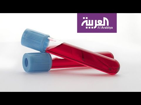 شاهد الكشف عن فحص دم يكشف التوحد