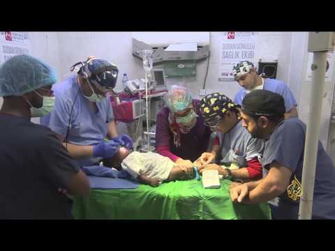 شاهد إجراء ألف عملية جراحية للشفة الأرنبية في الخرطوم