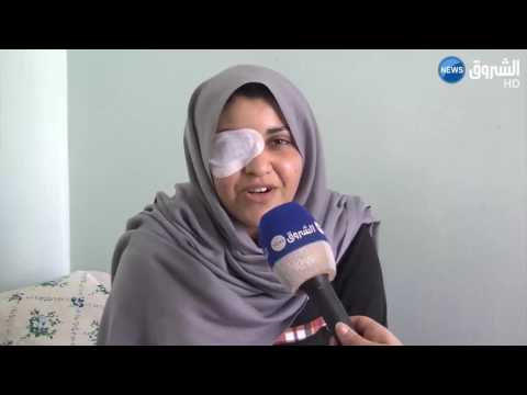 طاقم طبي جزائري ينجح في زراعة القرنية لعدد من المرضى في مستشفى ابن رشد