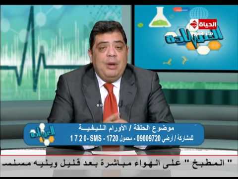 تعرف على كيفية تشخيص الأورام الليفية عند النساء