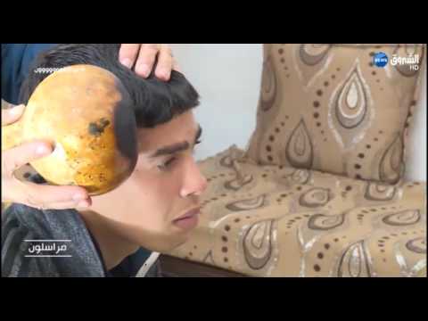 الرماد والقطران والدفلى مواد علاجية عند خالتي فاطمة