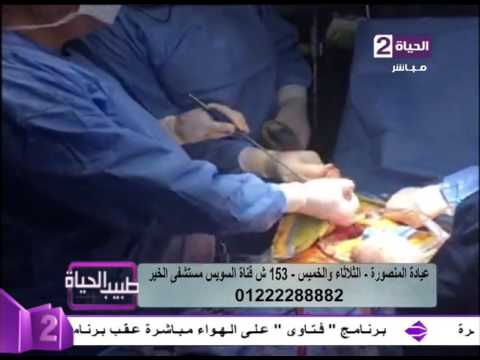 كيفية إجراء عملية تغيير صمامات القلب بالمنظار