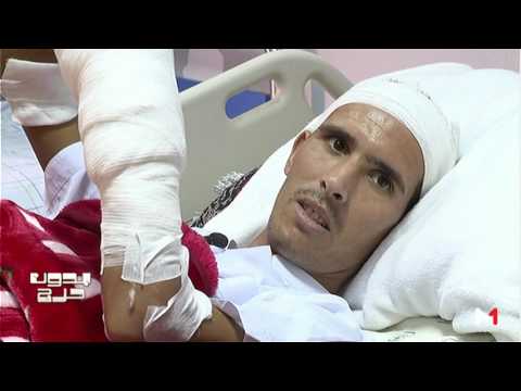 حالات تدمي القلب تتلقى العلاج في المركز الوطني لعلاج الحروق