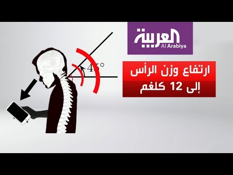 عنق المحمول مرض جديد سببه الأجهزة الذكية
