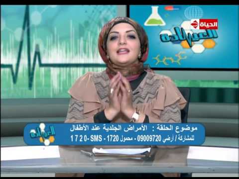 بالفيديو تعرف على أسباب ظهور حب الشباب وكيفية علاجها
