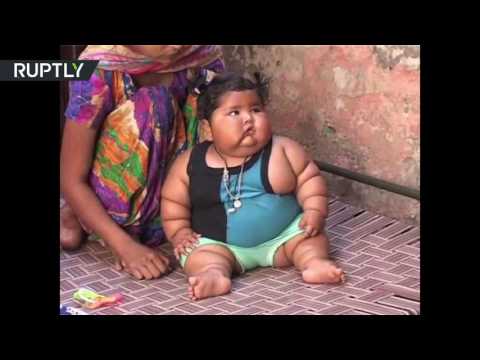 شاهد رضيعة هندية عمرها 8 أشهر تزن 17 كيلوغرامًا