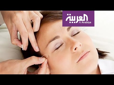 شاهد الإبر الصينية تعالج العقم والإدمان وتسد الشهية