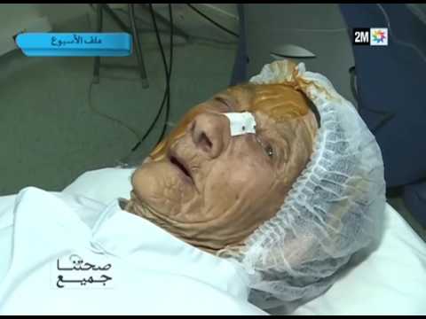 المياه البيضاء وكيفية التشخيص وطرق العلاج