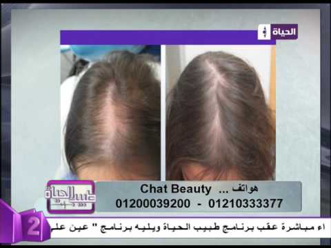 شاهد نتائج مبهرة في علاج مشاكل الشعر
