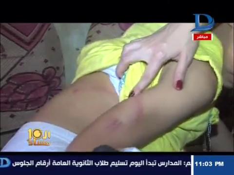 شاهد طفلة من البحيرة تروي تفاصيل اغتصابها داخل محل