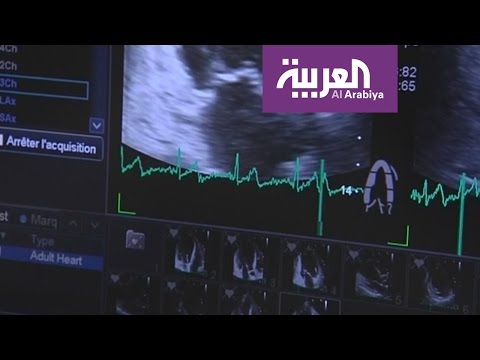 الأمراض التنفسية تسبب السكتات القلبية