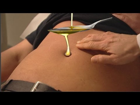 شاهد دراسة جديدة تكشف أنّ العسل يساعد في التخفيف من آلام الرأس