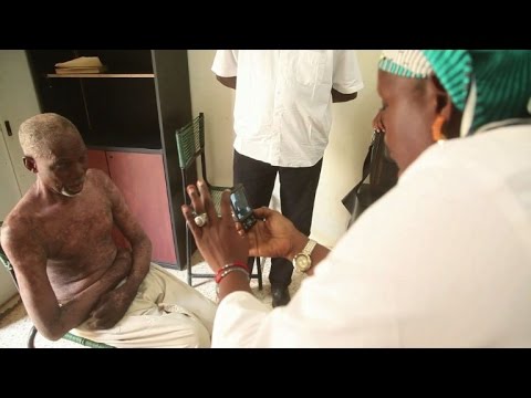 التشخيص الطبي عن بعد قد ينعش الصحة العامة في مالي
