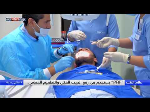 شاهد تعرّف على الأحدث في زراعة الأسنان