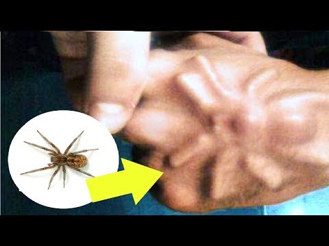 شاهد أغرب 10 أشياء وجدت داخل الجسم البشري