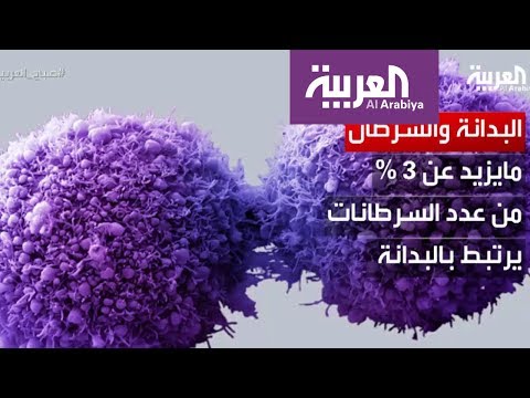 السكر مصدر خطر لنمو الخلايا السرطانية