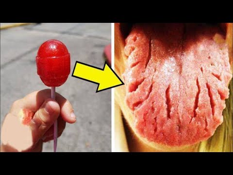 شاهد 7 أنواع من الحلوى تسبب العديد من الأمراض