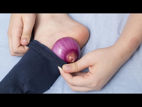 شاهد هذا ما سيحدث إذا وضعت قطعة من البصل في جوربك أثناء النوم
