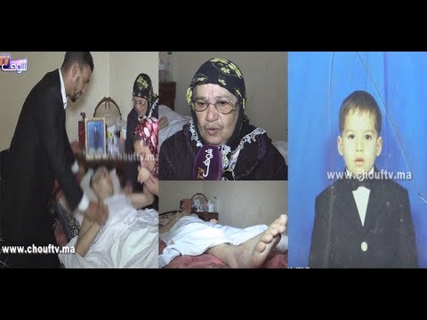 شاهد فيديو مؤثّر لمريض مغربي بدون عظام جمجمة