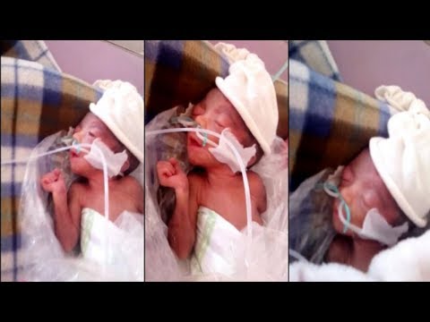 شاهد رضيع في مستشفى السويسي ملوي في بلاستيكة