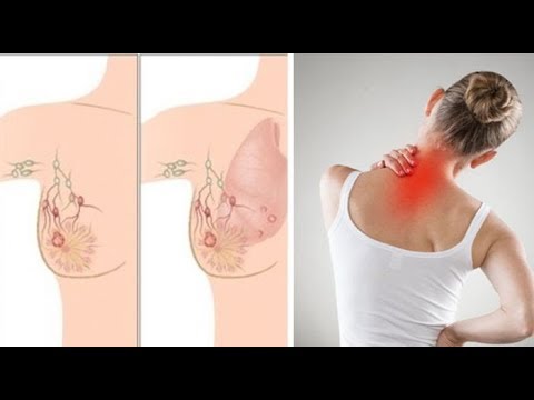 أول أعراض سرطان الثدي التي تتجاهلها النساء