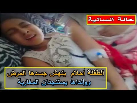 شاهد الطفلة أحلام تعيش على الآلام بعد أن نهش المرض جسدها