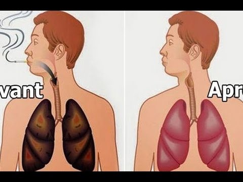 شاهد 4 أطعمة مذهلة يمكنها حمايتك من النيكوتين