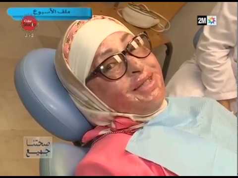 شاهد الفريق الطبي لصحتنا جميع يعيد البسمة لسيدة مغربية