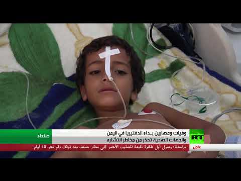تفشي داء الدفتيريا في اليمن