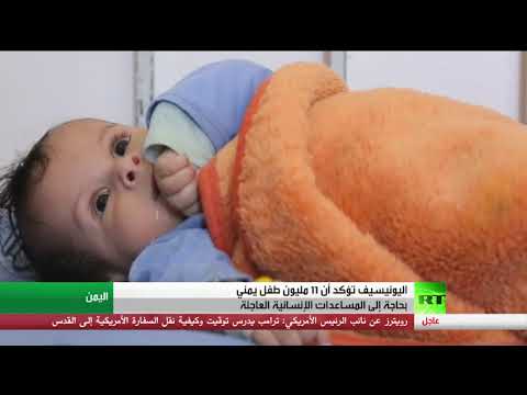 11 مليون طفل يمني بحاجة للمساعدات