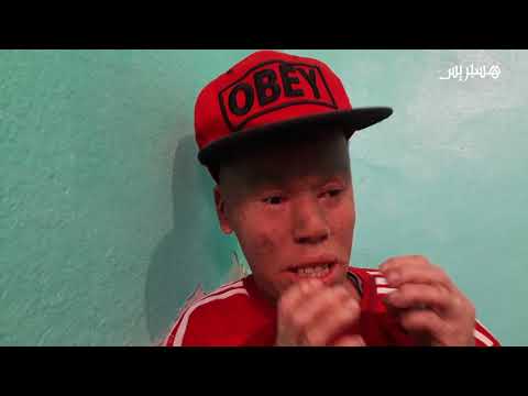 بالفيديو شخص من شباب القمر يوجه نداء استغاثة