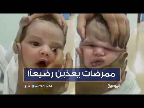 شاهد ممرضات يعذبن رضيعًا في مستشفى سعودية