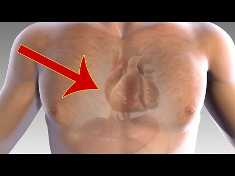 بالفيديو أهم أعراض الإصابة بـ الجلطة القلبية 