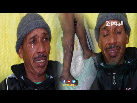 شاهد والد الخادمة لطيفة يكشف تفاصيل صادمة عن تعذيبها