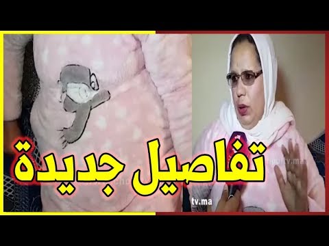 سيدة تخضع لعملية جراحية في أزرو