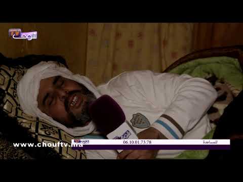 شاهد سائق سيارة أجرة في وجدة يصاب بمرض خطير