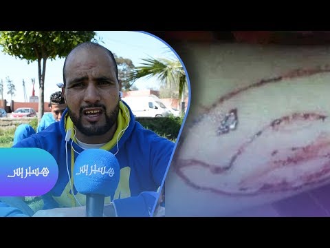 شاهد الحوت الأزرق يُثير الرعب في بن جرير