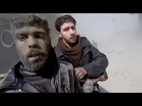 سكَّن الغوطة الشرقية ممزقون تحت تأثير القصف