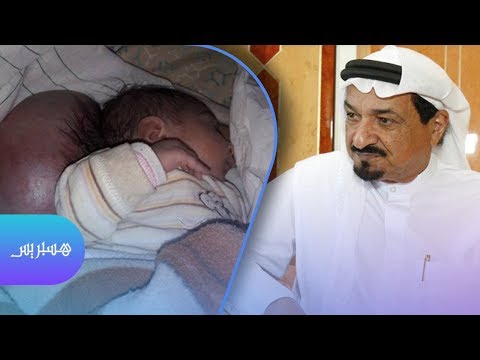 شاهد الشيخ حميد النعيمي يُفاجئ والد الطفلة التي ولدت برأسين