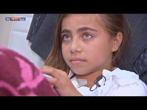شاهد إسرائيل تسمح لطفلة غزية بالعلاج دون مرافقة والدتها