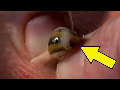 شاهد  العقرب أبرز 7 حشرات تقتل الانسان إذا لدغها