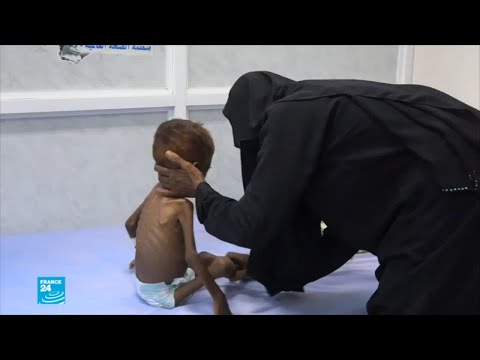 شاهد اليمن البلد الأكثر معاناة في العالم