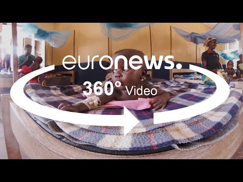 19 ألف طفل يعانون من سوء التغذية