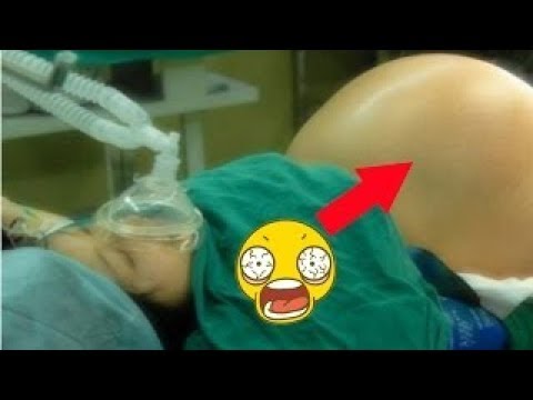 أم تنجب أكثر من طفل عند الولادة