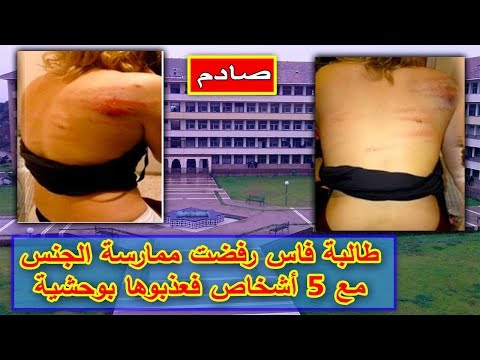 ماذا حدث لطالبة في مدينة فاس