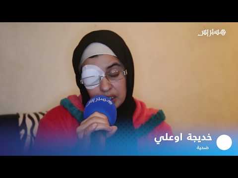 شاهد معاناة الناجين من حادث سيدي بيبي