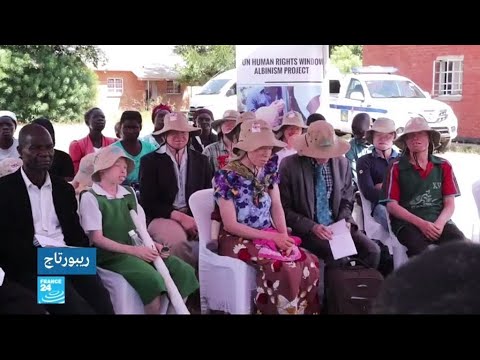 شاهدالتمييز والقتل يلاحقان المصابين بمرض المهق في ملاوي