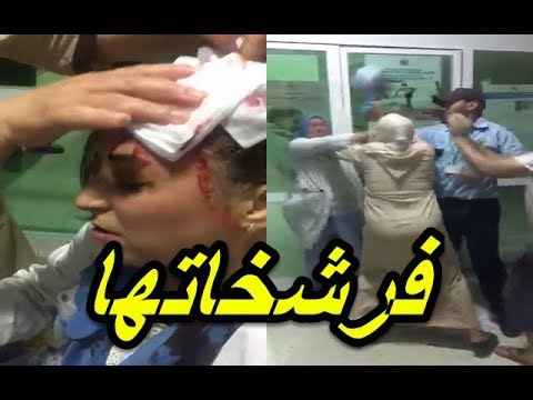 مواطنة تشق رأس ممرضة بالمستشفى الإقليمي في تاونات
