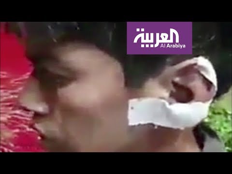 شاهد مقاولو طهران يستغلون الأطفال في جمع القمامة والبلدية تقطع أذن أحدهم